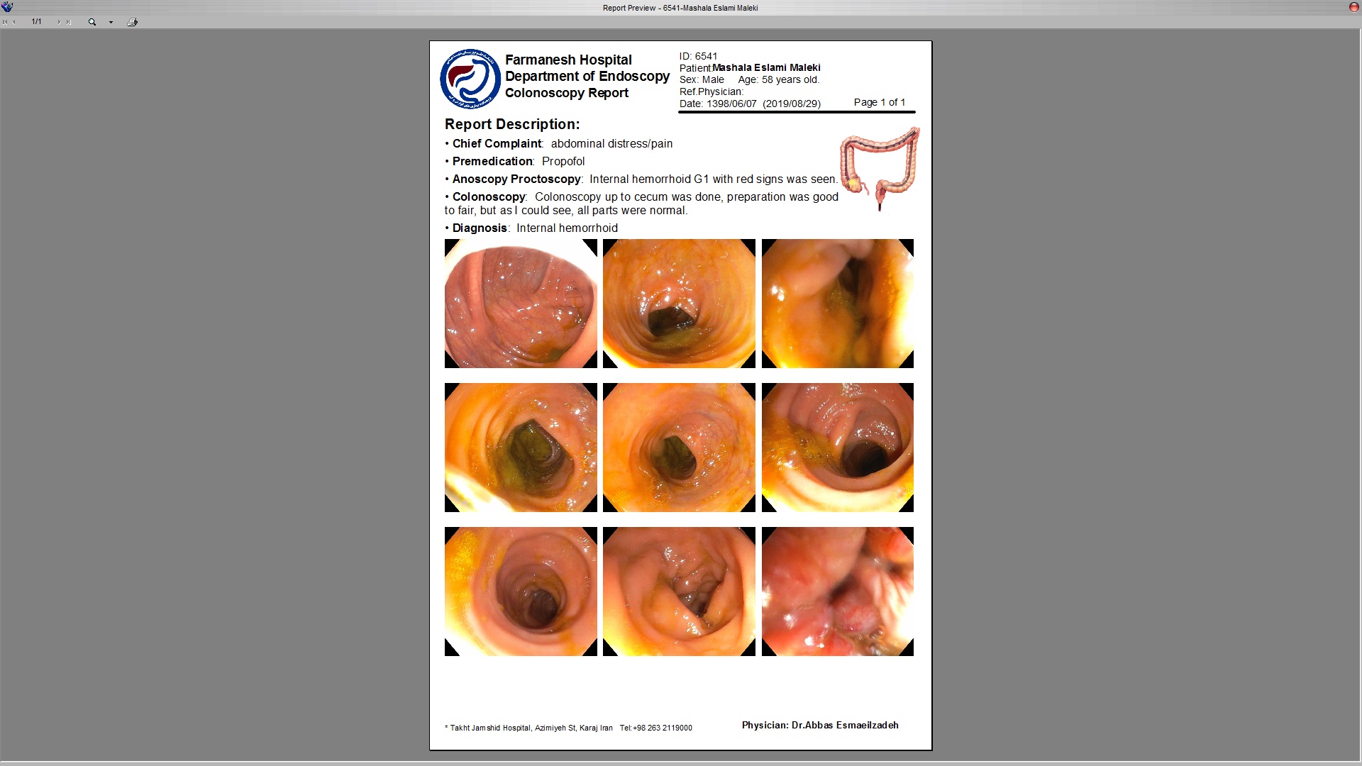 Endoscopic Retrograde Cholangiopancreatography