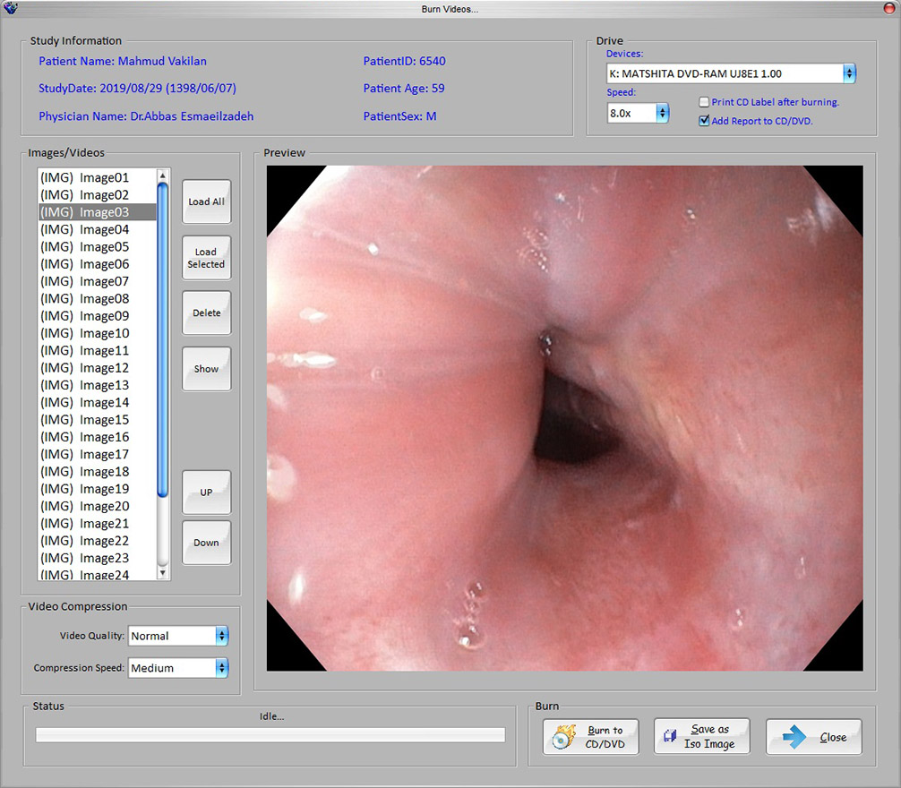 Endoscopy-software